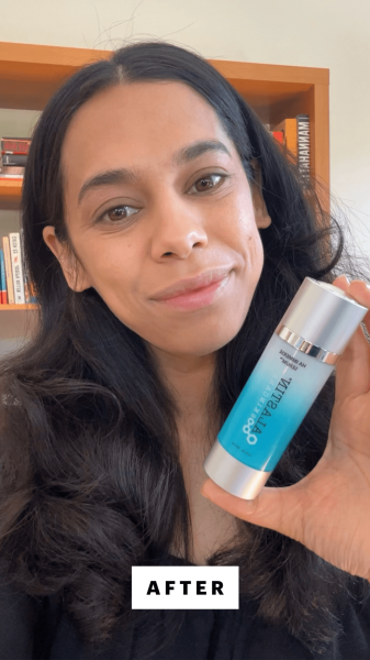 Shipin after applying the Alastin HA Immerse Serum